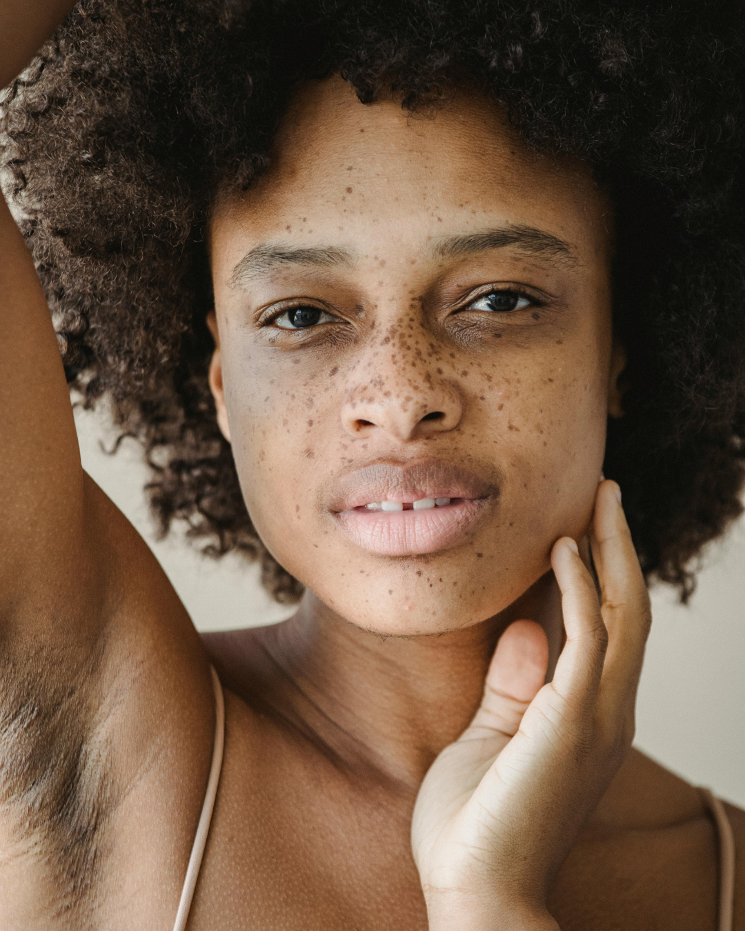 Dark Underarms in Melanin-Rich Skin: What Actually Helps?